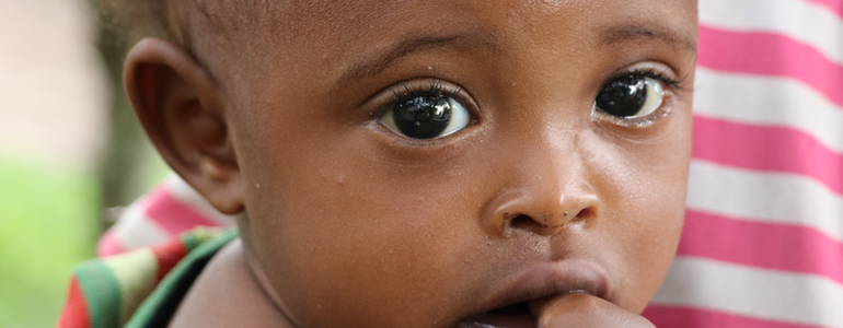 Portrait eines afrikanischen Kindes das traurig blickt und von seiner Mutter gehalten wird.